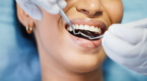 Best Cracked Tooth Emergency Dentist  in Fairfield University, CT